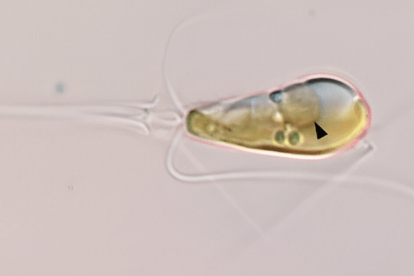 nitrogen-fixing organelle ias toppers