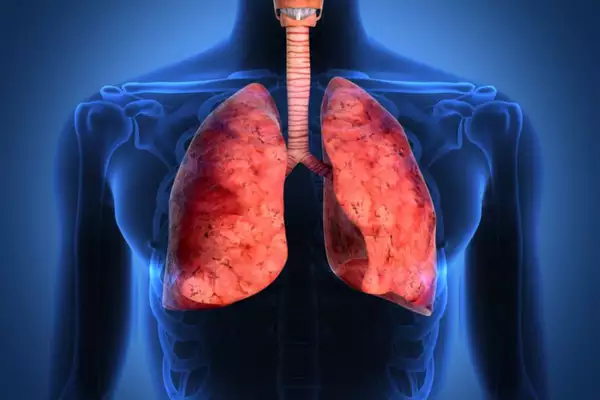 World-first lung cancer vaccine trials launched