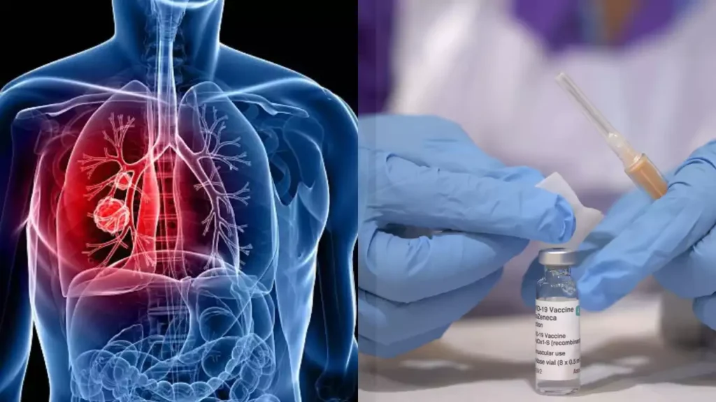 World first lung cancer vaccine trials launched